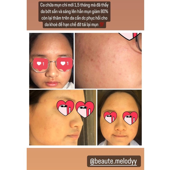 Gel chấm mụn Der..me…dic