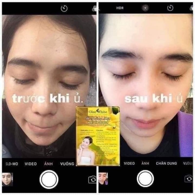 Ủ Trắng mặt huyết yến collagen