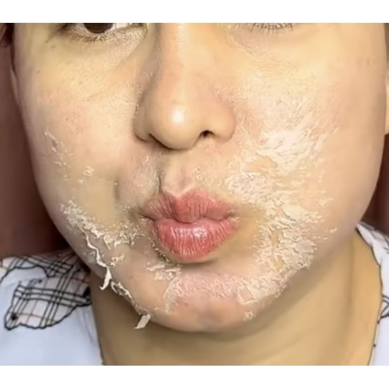 Peel Da Mặt Collagen Cao Cấp Tái Tạo Trắng Da Mờ Thâm Nám Tàn Nhang