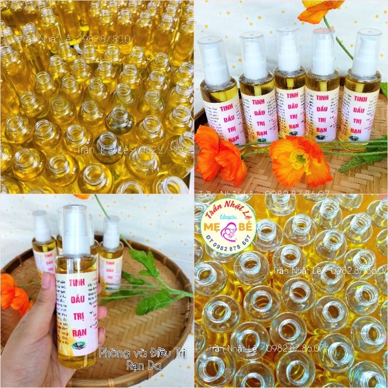 TINH DẦU RẠN DA