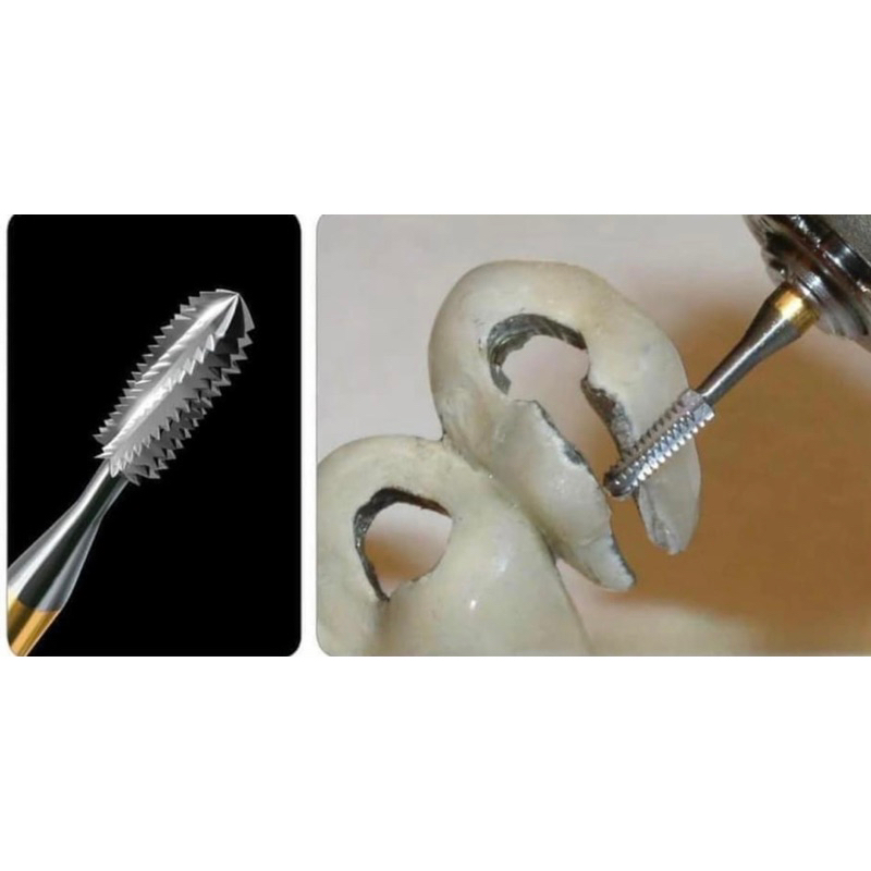 Thanh lý mũi cắt mão răng sứ kim loại, răng full sứ, mão thép. mũi khoan cắt cầu răng lắp vào tay khoan nhanh