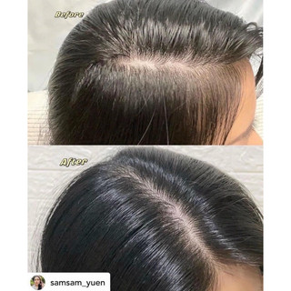 Tinh chất kích thích mọc tóc Kerastase Densifique