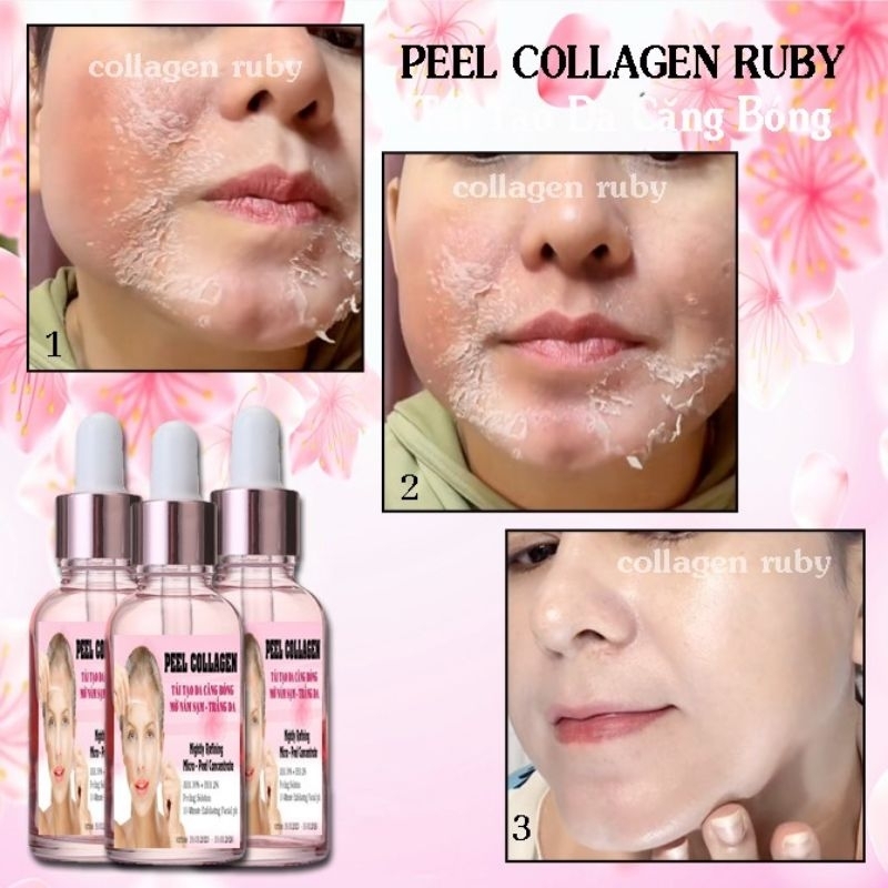 Peel Da Mặt Collagen Cao Cấp Tái Tạo Trắng Da Mờ Thâm Nám Tàn Nhang