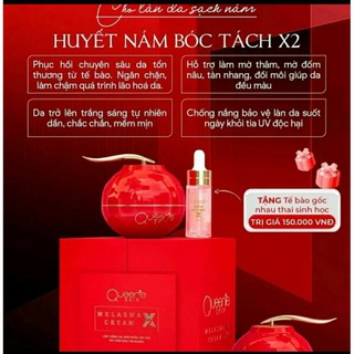 KEM DƯỠNG DA MẶT NGĂN NGỪA NÁM TÀN NHANG CỦA QUEENIE SKIN