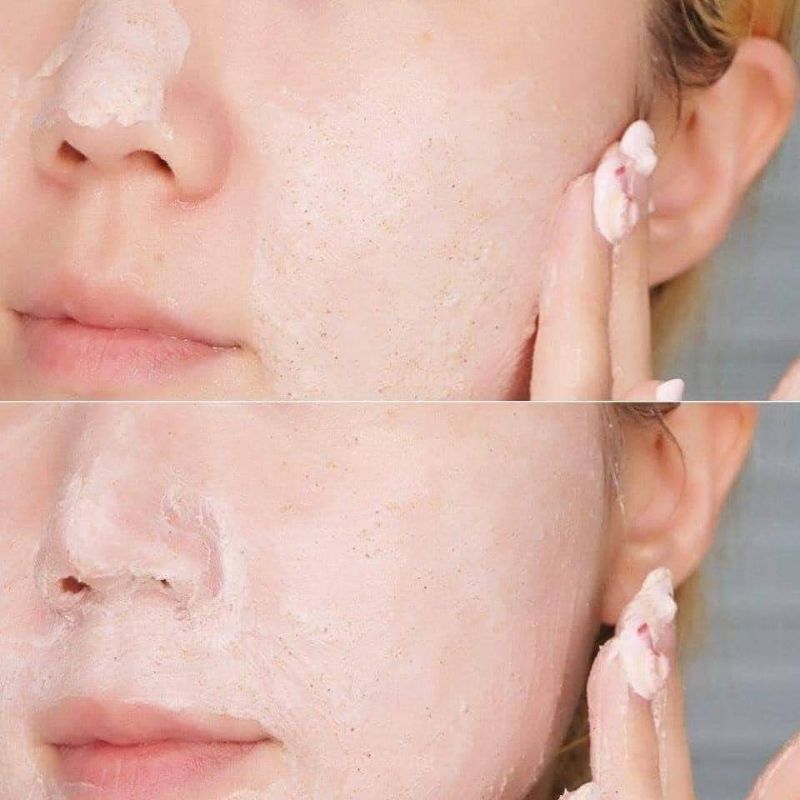 Sữa Rửa Mặt Tẩy Tế Bào Chết St.Ives 170g Chiết xuất Bơ &amp; Mật Ong của Mỹ