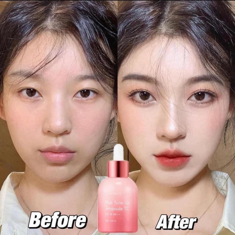 𝐒𝐞𝐫𝐮𝐦 𝐂𝐞𝐥𝐥𝐚𝐩𝐲 𝐏𝐢𝐧𝐤 𝐓𝐨𝐧𝐞 𝐔𝐩 𝐀𝐦𝐩𝐨𝐮𝐥𝐞