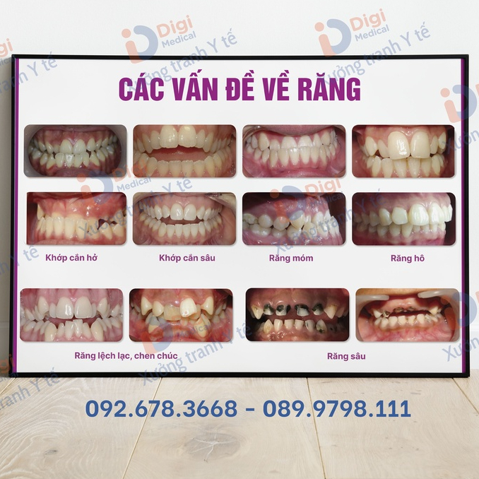 (Tranh Khung) Tranh Nha Khoa - Các Vấn Đề Về Răng