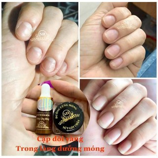 Combo đánh bay nấm và phục hồi hư tổn