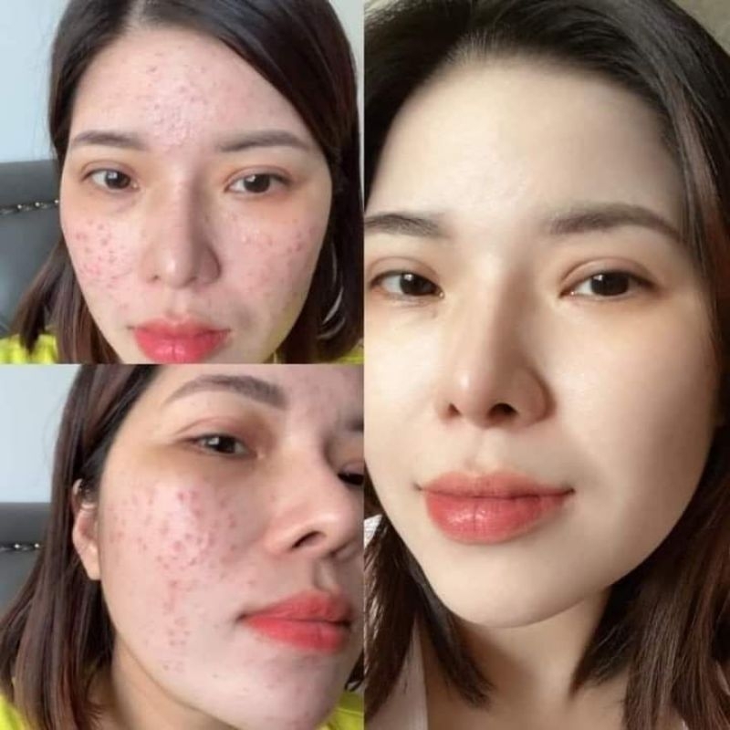 Combo kem tái tạo vàng và kem tái tạo kim cương chamomileskill hàng chuẩn