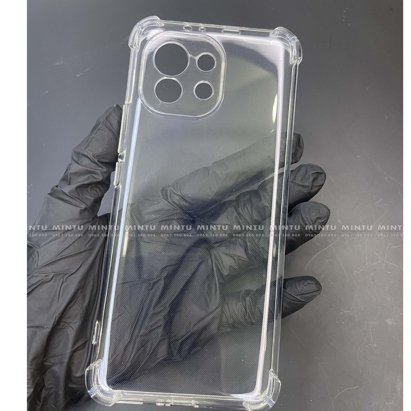 Ốp Xiaomi Mi 11 - Loại trong suốt chống sốc