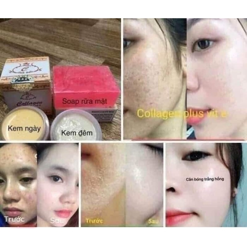 Set serum +colazen ngày đêm plus vit e