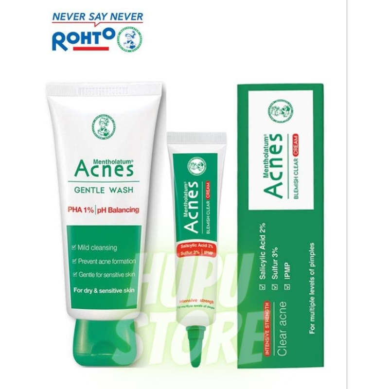 COMBO 3 MÓN ACNES NGỪA MỤN