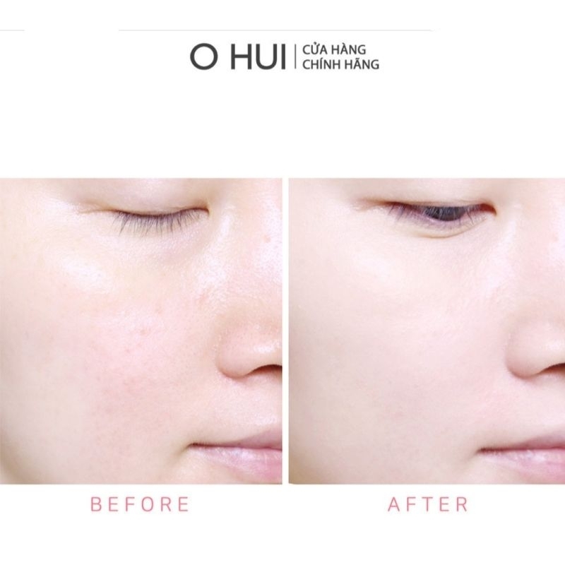 Sét kem nền dạng thỏi phiên bản giới hạn đặc biệt OHUI Ultimate Cover Stick Foundation