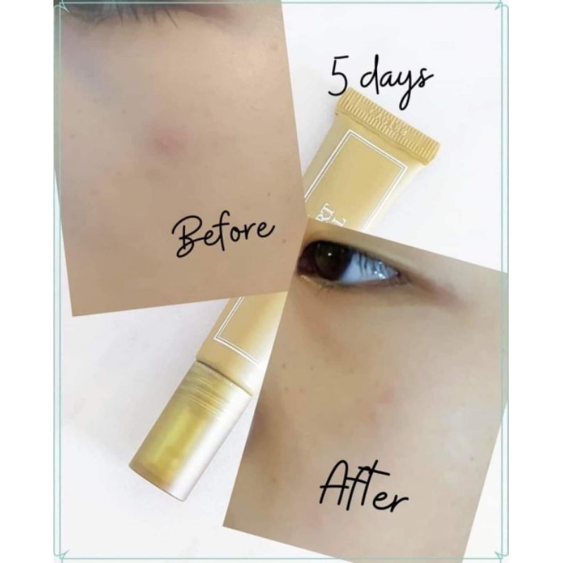 Gel Chấm Mụn Ngải Cứu I'm From Mugwort Spot Gel 15g