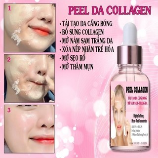 Peel lột tái tạo trắng da xóa nám sạm tàn nhang trắng da collagen