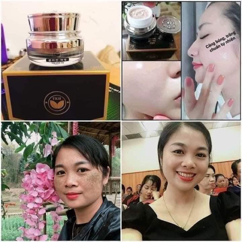 KEM DƯỠNG TRẮNG DA NGĂN NGỪA NÁM TKH