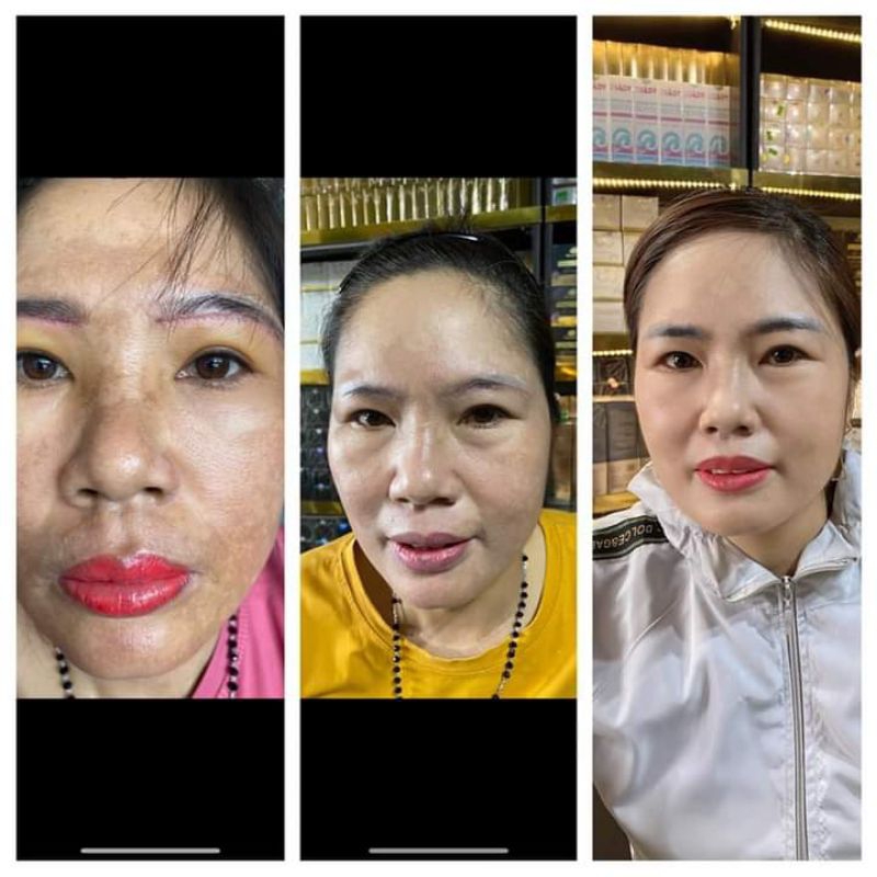 Cao nám hoàng cung_ mờ nám, dưỡng trắng da