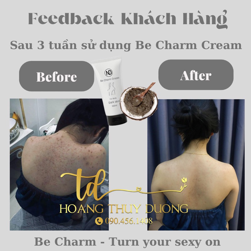 KEM BE CHARM XOÁ THÂM VÒNG 3