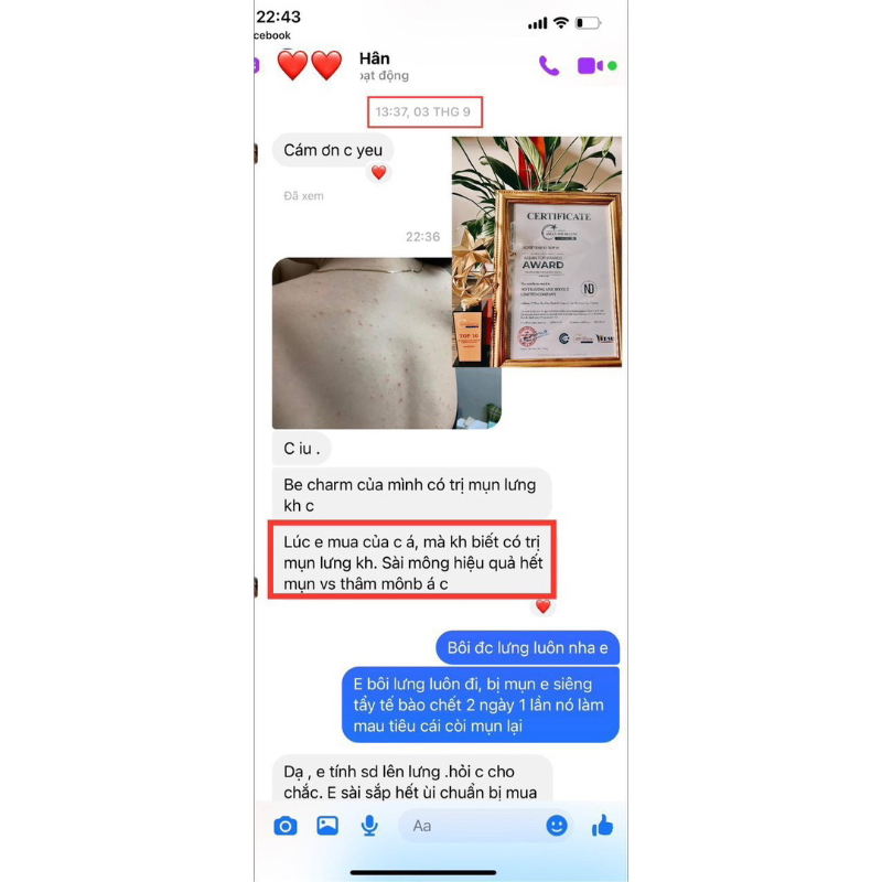 KEM BE CHARM XOÁ THÂM VÒNG 3