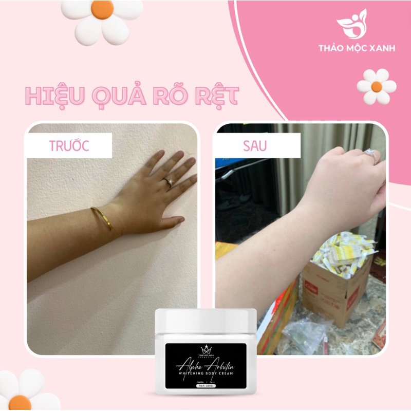 Kem body alpha arbutin