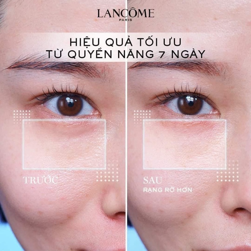 KEM MẮT GIẢM THÂM, CHỐNG LÃO HOÁ LANCOME ADVANCED GÉNIFIQUE YEUX 5ML