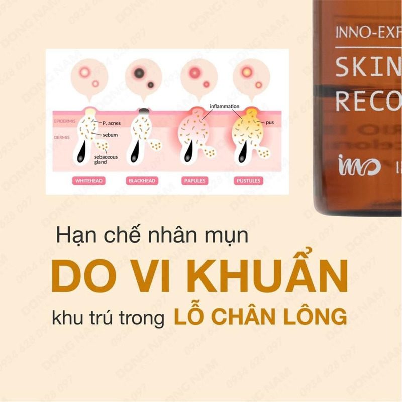 Peel da Skin Recovery 1805