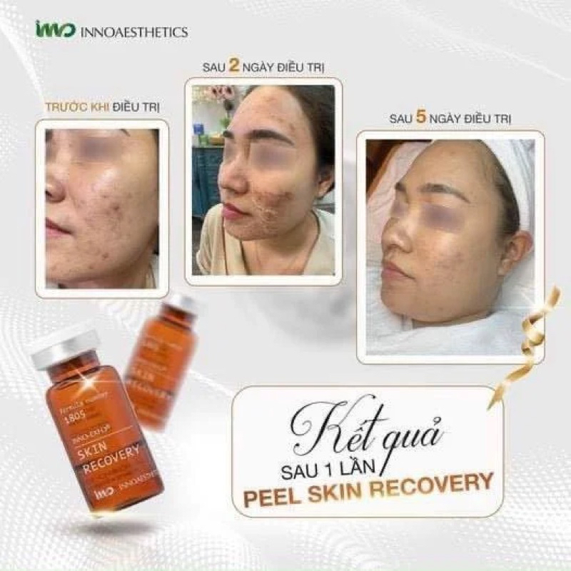 Peel da Skin Recovery 1805