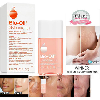 Dầu dưỡng chăm sóc da bio-oil 60ml / 125ml/200ml