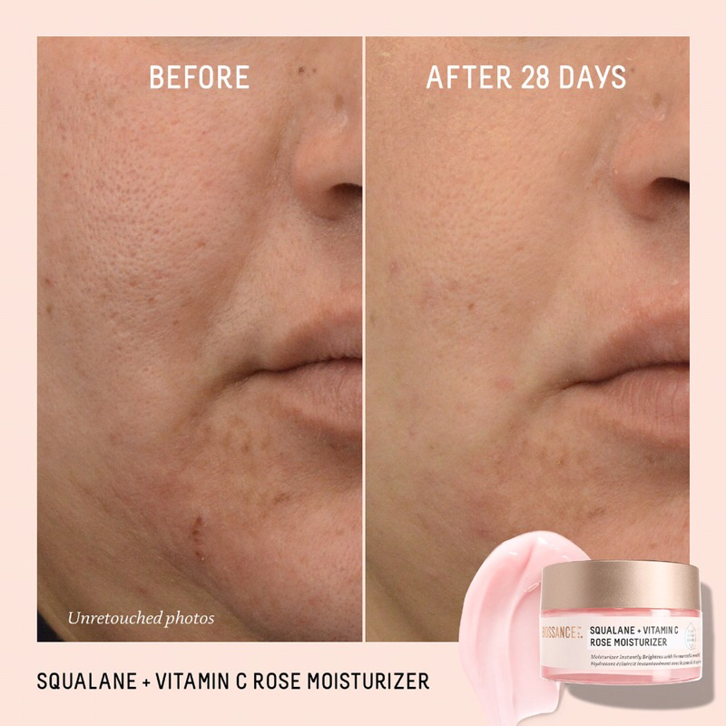 Kem dưỡng ẩm và làm sáng mịn da Biossance SQUALANE + VITAMIN C ROSE MOISTURIZER