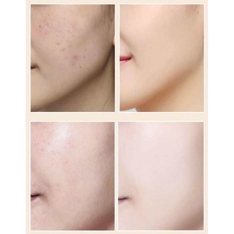 Kem Nền Trang Điểm Che Khuyết Điểm BB Cream Lameila Lâu Chôi Dưỡng Trắng Da