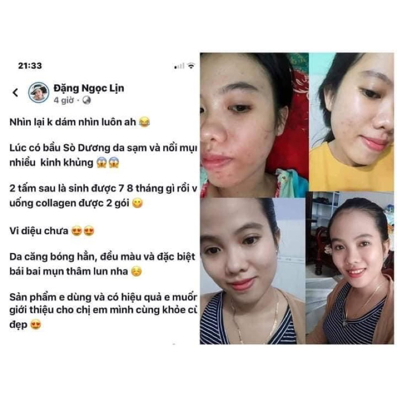 MARINE COLLAGEN HÀM LƯỢNG 5000mg NGUYÊN CHẤT TỪ VẢY CÁ, KHÔNG NÓNG TRONG NỔI MỤN