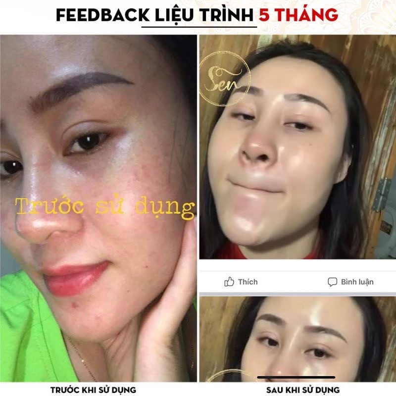 Tinh chất sen