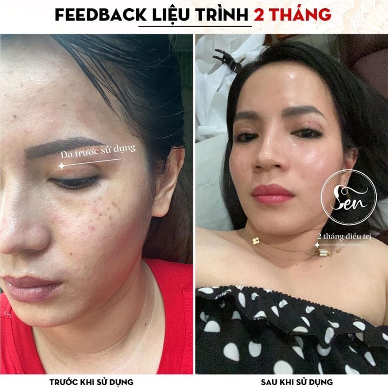 Tinh chất sen