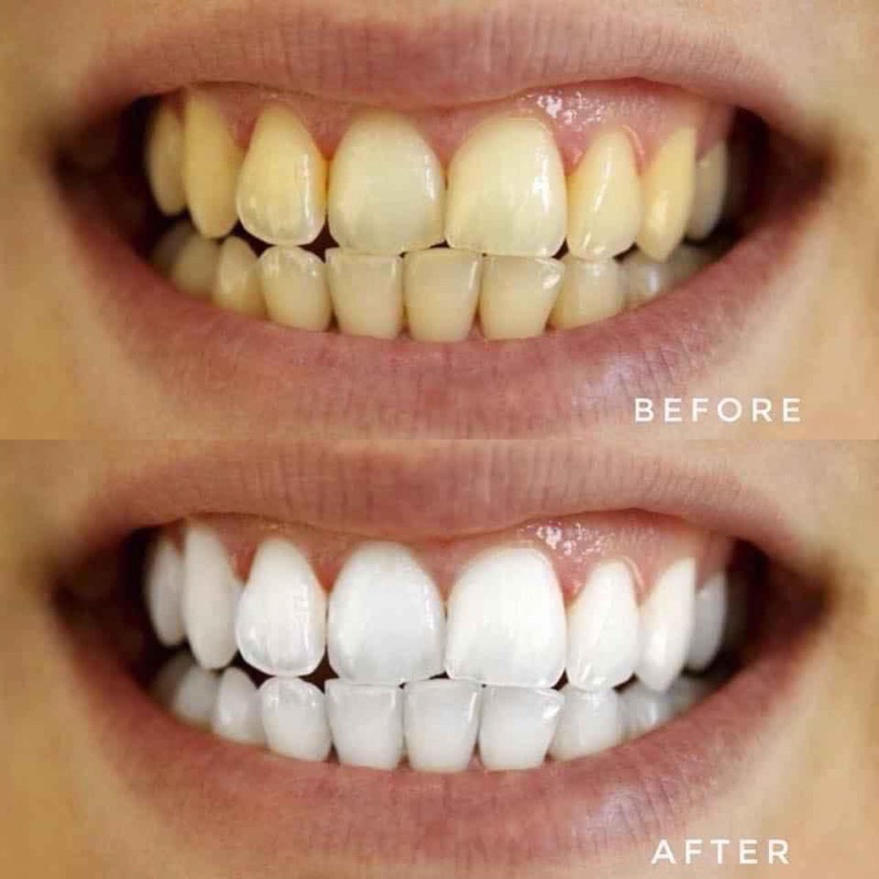 Bột đánh răng Supaporn chiết xuất thảo mộc trắng răng thơm miệng 90g