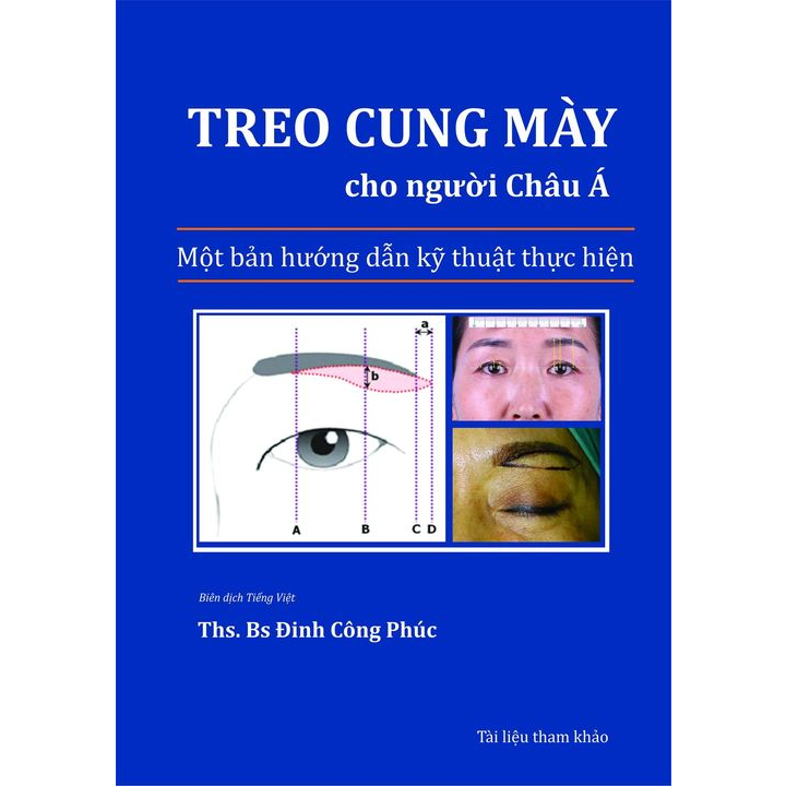 Y HỌC. Sách Treo cung mày người châu á, Phòng khám thẩm mỹ .Thư Viện Y Khoa.