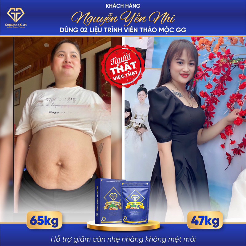 Viên Thảo Mộc GG combo 2 hộp-Giảm Cân Chính Hãng | BigBuy360 - bigbuy360.vn
