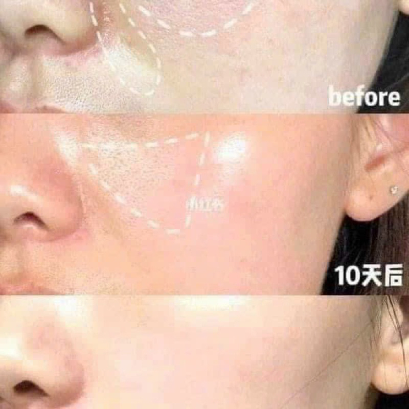 SERUM GLOW MELLOW NIACIAMIDE 20% ARBUTIN 3% FULL 30ML