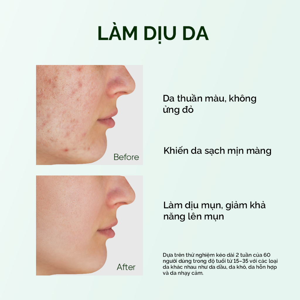 Thanh lăn mặt nạ đất sét ngải cứu giảm mụn SKINTIFIC 40g (đơn lẻ)