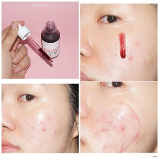 Serum RED PEEL TINGLE - White Serum tinh chất thay da sinh học peel da nhập khẩu chính hãng 35ml