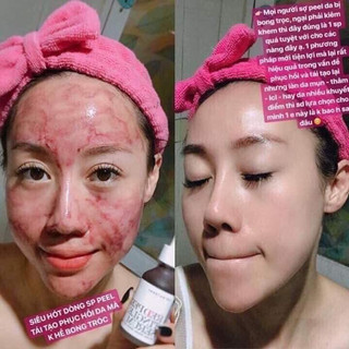 Serum RED PEEL TINGLE - White Serum tinh chất thay da sinh học peel da nhập khẩu chính hãng 35ml