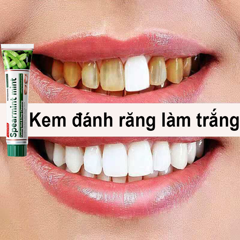 Kem đánh răng làm trắng răng, giảm vết ố vàng trên răng, giảm sâu răng, hít thở tươi mát và khử mùi suốt cả ngày