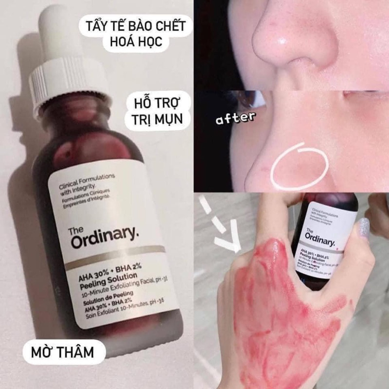 The Ordinary AHA 30% BHA 2% 💟 BILL SEPHORA ẢNH CUỐI
