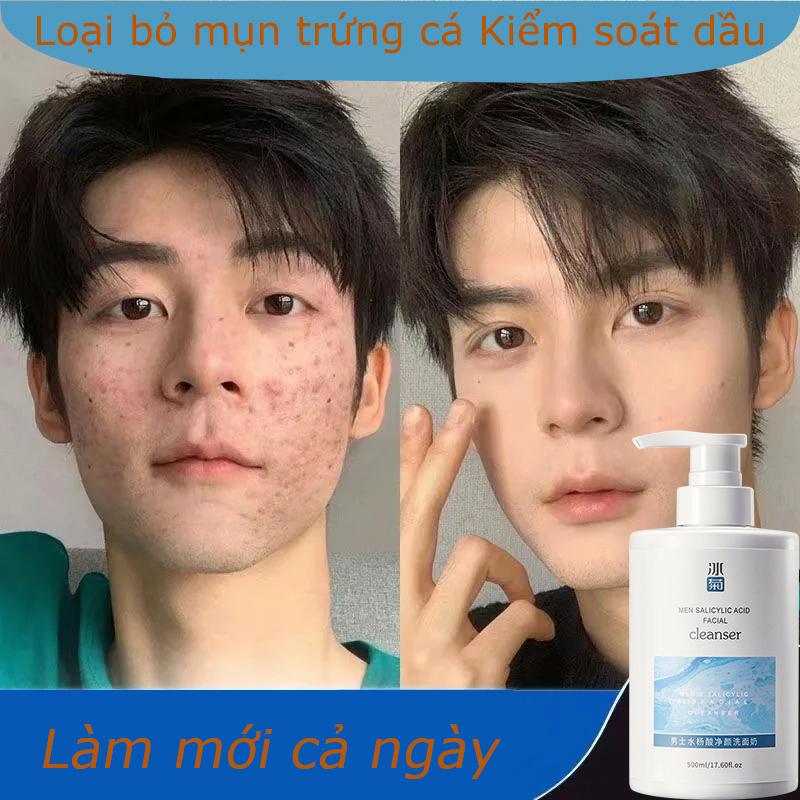 sữa rửa mặt kiểm soát dầu axit salicylic 500ml Làm sạch sâu Loại bỏ mụn trứng cá hiệu quả Làm trắng và giữ ẩm