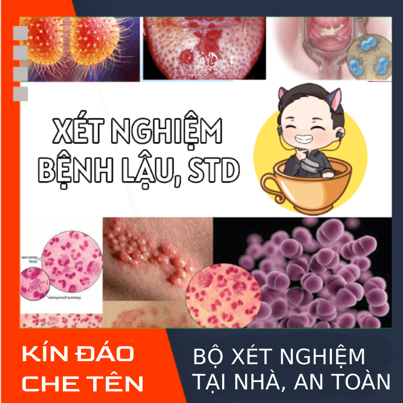 Test nhanh chuẩn đoán lậu, xét nghiệm STD bệnh lậu TẠI NHÀ GONORRHEA RAPID TEST