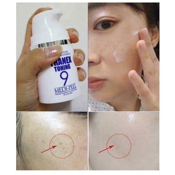 Tinh chất nám Medi-peel Tranex Toning 9 Essence 50ml màu xanh - Harin Cosmetics