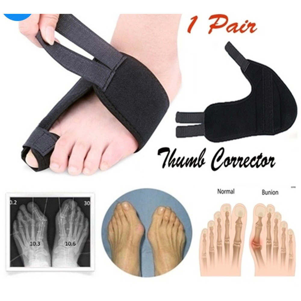 Nẹp Định Hình Bàn Chân, Ngón Chân Cái, Nẹp Ngón Chân Cái, Nẹp Chỉnh Hình Bàn Chân, Nẹp ngón Chân Cái