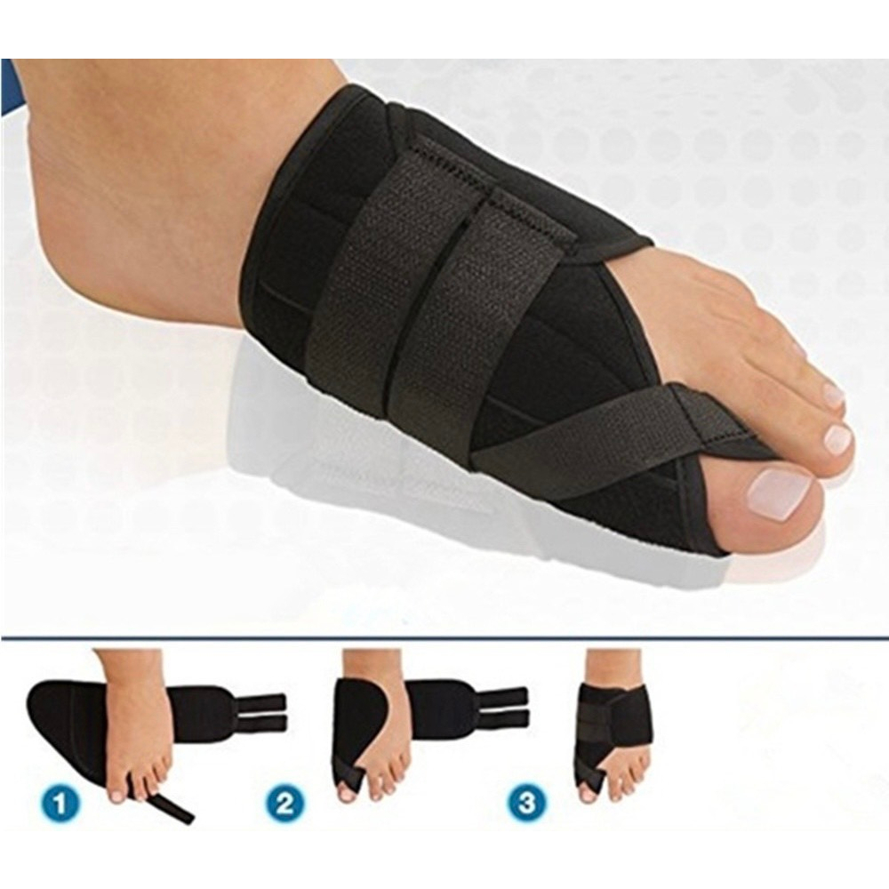 Nẹp Định Hình Bàn Chân, Ngón Chân Cái, Nẹp Ngón Chân Cái, Nẹp Chỉnh Hình Bàn Chân, Nẹp ngón Chân Cái