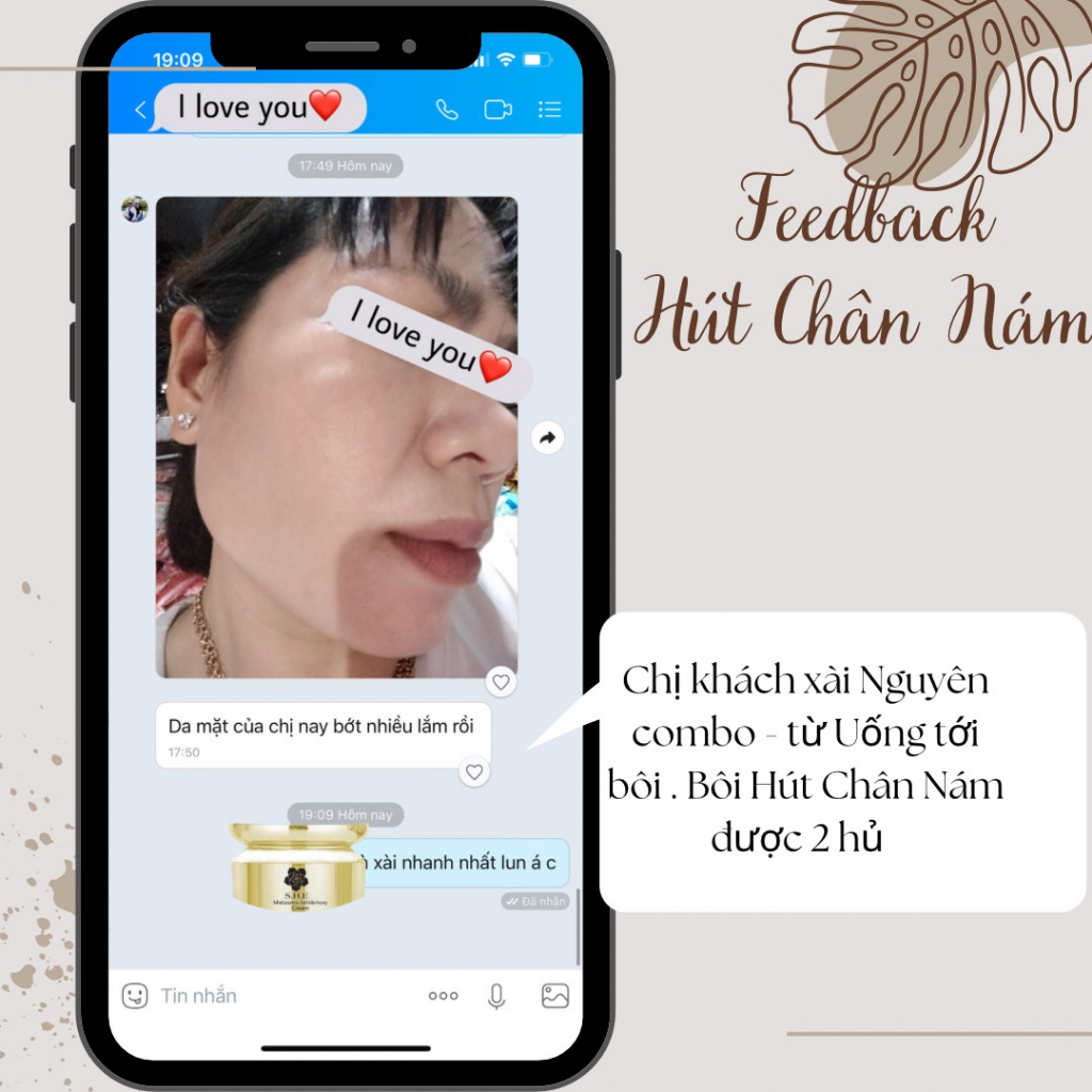 Kem Dưỡng Ức Chế - Hút Chân Nám - Tàn Nhang She Peeling