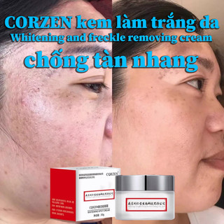 Kem nám tàn nhang Hoa mẫu đơn làm trắng da Ngày Và Đêm chống lão hóa Whitening Cream 30g/60g