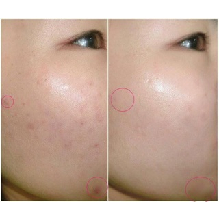 Serum Tinh Chất Dưỡng Trắng Da Balance Active Formula Vitamin C Brightening 30ml